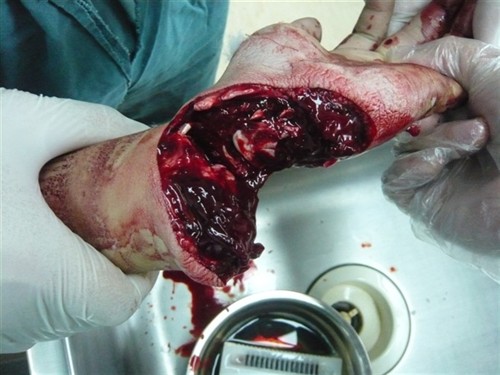 什么是正义什么是公理-如何既坚持了正义公理