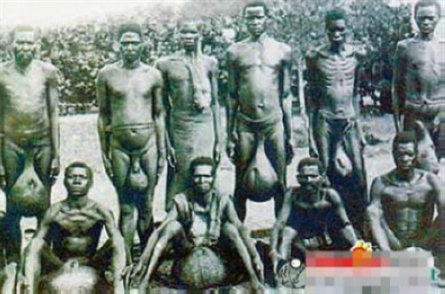 世界上<em>生殖器</em>最大的民族:--<em>非洲象人族</em>