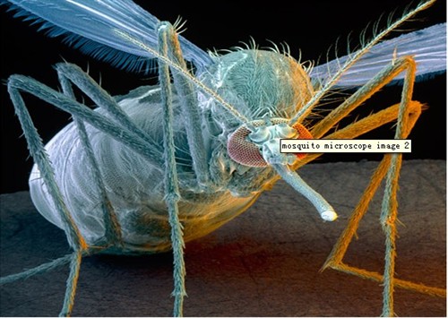 【慎入】扫描式电子显微镜下的高清蚊子图像