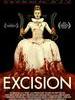 切除/Excision